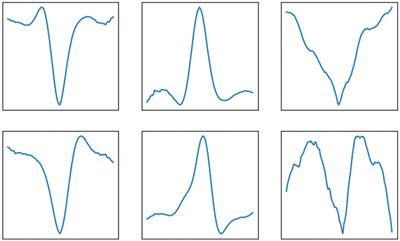 Deep unfolding for multi-measurement vector convolutional sparse coding to denoise unobtrusive electrocardiography signals
